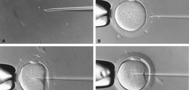 كيف تتم عملية الحقن المجهري صورة مقال كيف تتم عملية الحقن المجهري