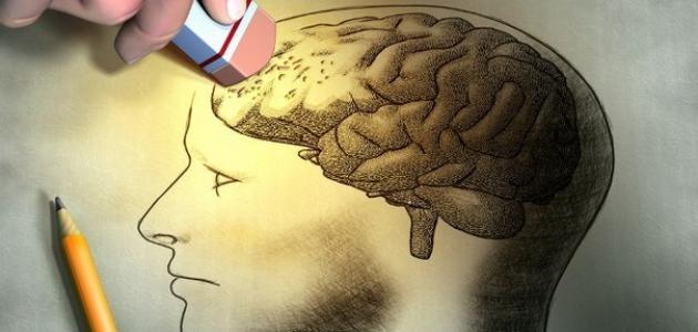أسباب ضعف الذاكرة صورة مقال أسباب ضعف الذاكرة