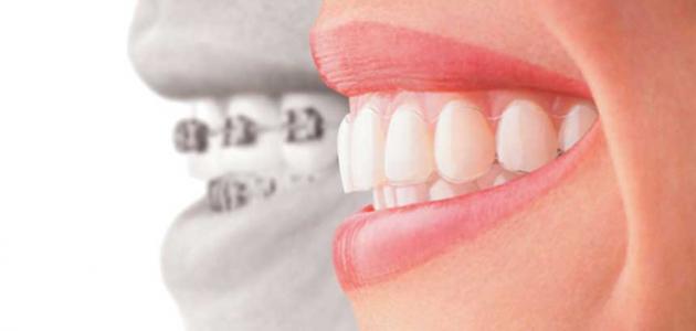 كيف أنظف أسناني صورة مقال كيف أنظف أسناني