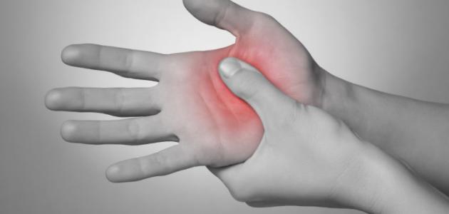 ما هي أعراض الروماتويد صورة مقال ما هي أعراض الروماتويد