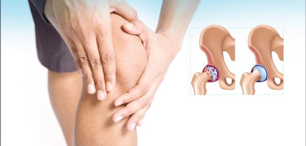 كيفية علاج الآم المفاصل صورة مقال كيفية علاج الآم المفاصل