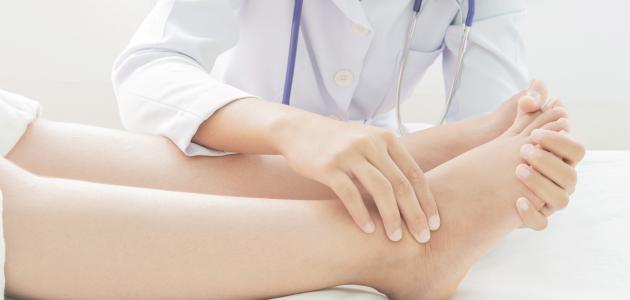 ما هي أسباب تورم القدمين صورة مقال ما هي أسباب تورم القدمين