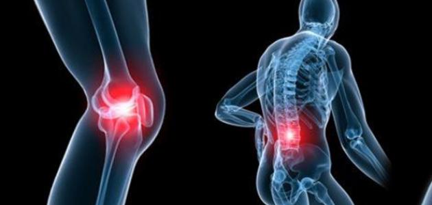 آلام المفاصل صورة مقال آلام المفاصل