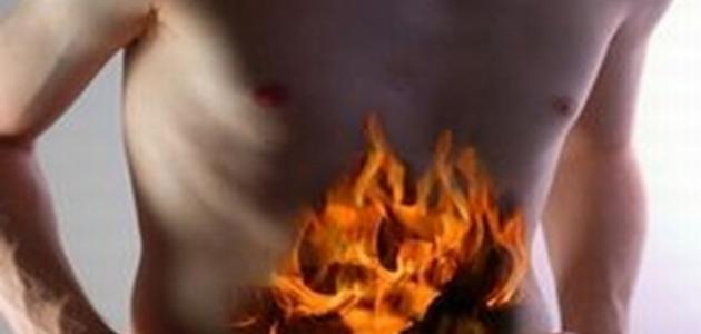 كيف أتخلص من حرقة المعدة صورة مقال كيف أتخلص من حرقة المعدة