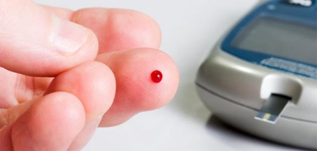 كيف أعرف أنه عندي سكر صورة مقال كيف أعرف أنه عندي سكر