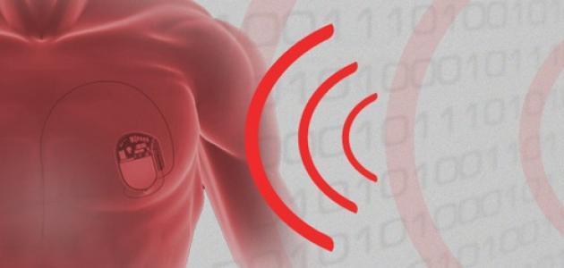 أعراض زيادة كهرباء القلب صورة مقال أعراض زيادة كهرباء القلب