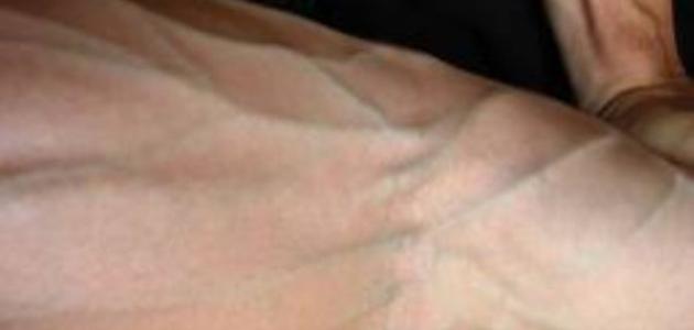 كيف تظهر عروق اليد صورة مقال كيف تظهر عروق اليد