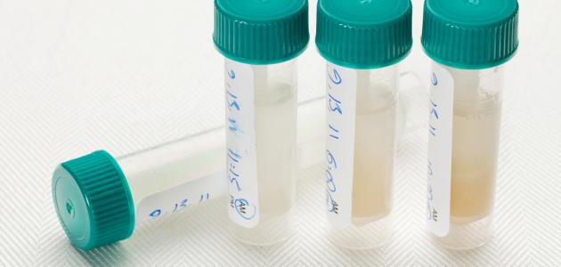 تحليل هرمون الحليب صورة مقال تحليل هرمون الحليب