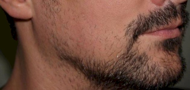 عدم ظهور شعر الذقن والوجه أسبابه وعلاجه صورة مقال عدم ظهور شعر الذقن والوجه أسبابه وعلاجه