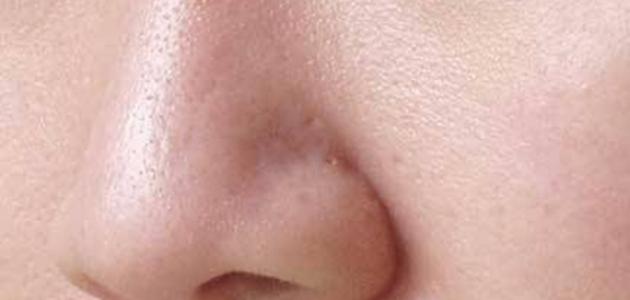 كيف أقفل مسامات وجهي صورة مقال كيف أقفل مسامات وجهي