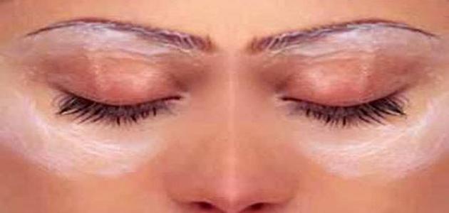 كيف أتخلص من البقع السوداء تحت العين صورة مقال كيف أتخلص من البقع السوداء تحت العين