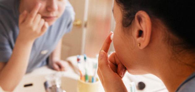 علاج آثار حب الشباب صورة مقال علاج آثار حب الشباب