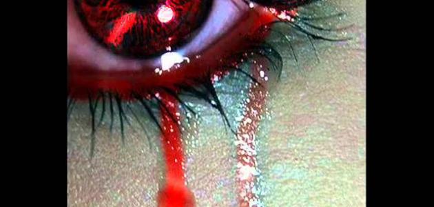 كلام قلب مجروح صورة مقال كلام قلب مجروح