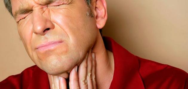 أعراض احتقان الحلق صورة مقال أعراض احتقان الحلق