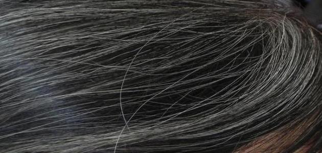 أسباب ظهور الشعر الأبيض صورة مقال أسباب ظهور الشعر الأبيض