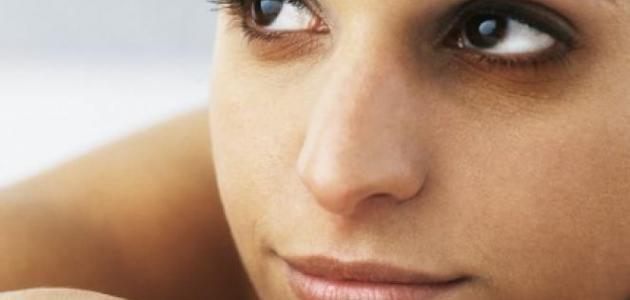 أسباب الهالات السوداء تحت العين صورة مقال أسباب الهالات السوداء تحت العين