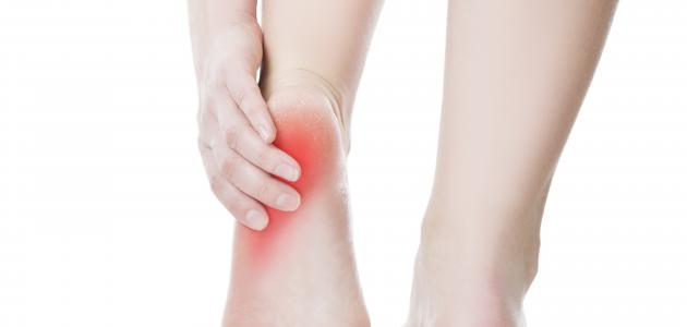 أسباب حرارة باطن القدم صورة مقال أسباب حرارة باطن القدم