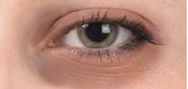 علاج للسواد تحت العين صورة مقال علاج للسواد تحت العين