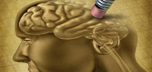 أعراض ضمور المخ صورة مقال أعراض ضمور المخ