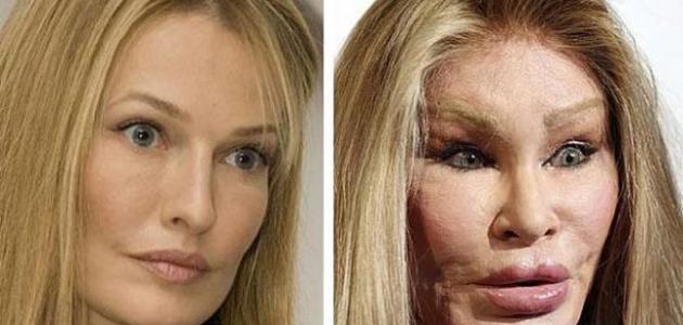 أضرار عمليات التجميل صورة مقال أضرار عمليات التجميل