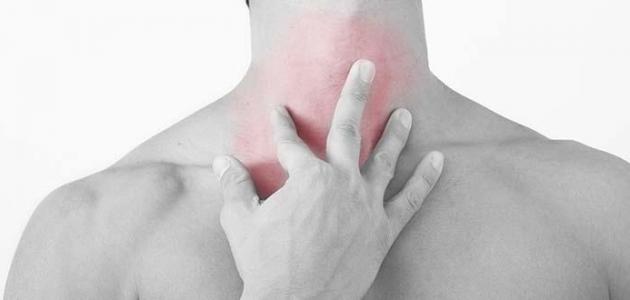 علاج بحة الصوت والتهاب الحلق صورة مقال علاج بحة الصوت والتهاب الحلق