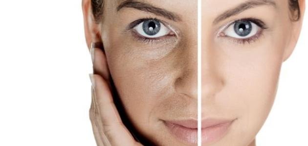 أضرار الكولاجين للبشرة صورة مقال أضرار الكولاجين للبشرة