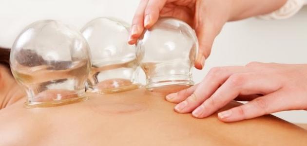 فوائد الحجامة للنساء صورة مقال فوائد الحجامة للنساء