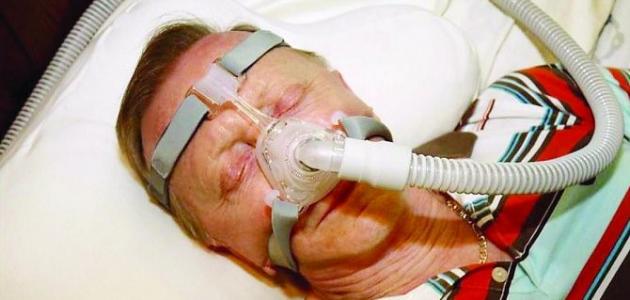 ما هو مرض الإنصباب البلوري و ما هي أعراضه صورة مقال ما هو مرض الإنصباب البلوري و ما هي أعراضه