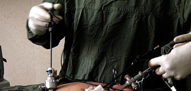 جراحة المنظار صورة مقال جراحة المنظار