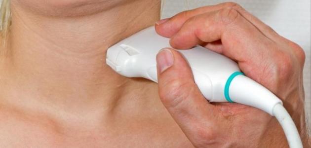 علاج تضخم الغدة الدرقية صورة مقال علاج تضخم الغدة الدرقية