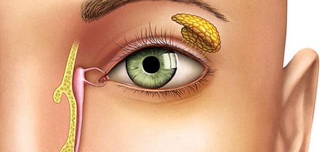 انسداد القناة الدمعية صورة مقال انسداد القناة الدمعية