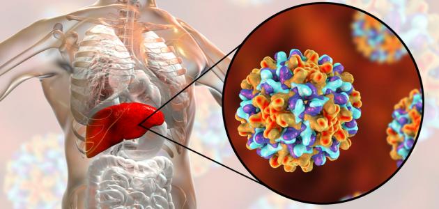 فيروس الكبد ب صورة مقال فيروس الكبد ب