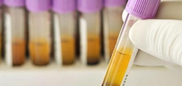 ما هي سرعة الترسيب صورة مقال ما هي سرعة الترسيب