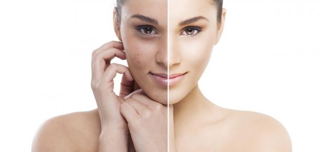 فوائد التقشير الكريستالي صورة مقال فوائد التقشير الكريستالي